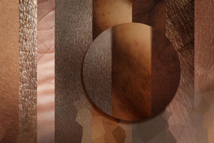 Diagnosing Diseases in Darker Skin Tones Poses Challenges for Doctors