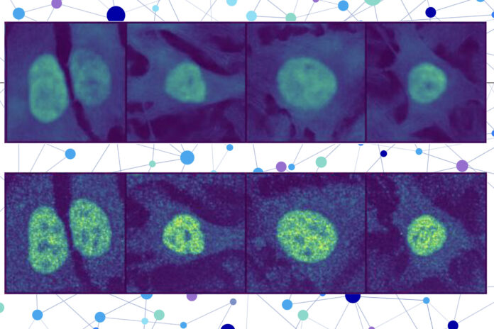 AI Predicts Protein Locations in Human Cells